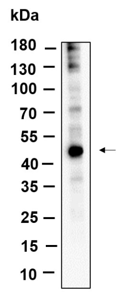 Recombinant YB-1 Monoclonal Antibody (AN301185L)