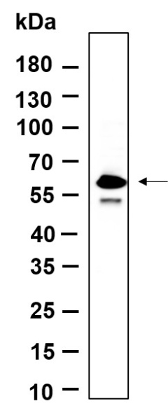 Recombinant Phospho-SMAD5 (Ser463, Ser465) Monoclonal Antibody (AN300655L)