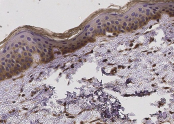 Recombinant FCGRT & B2M Heterodimer Monoclonal Antibody (AN300593P)