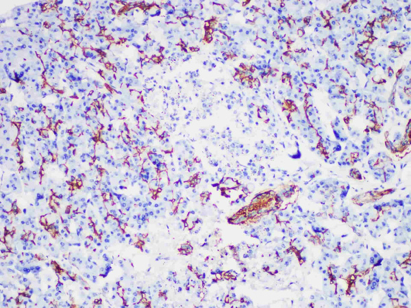 CA19-9 Monoclonal Antibody (ELAB6950-M)