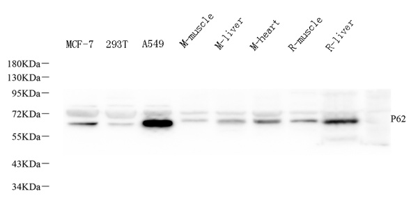 P62/SQSTM1 Polyclonal Antibody (E-AB-70325)