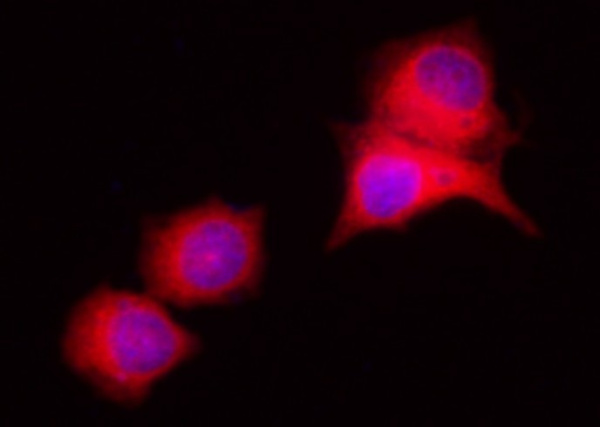 Recombinant LRPAP1/A2MRAP Monoclonal Antibody (AN300219P)