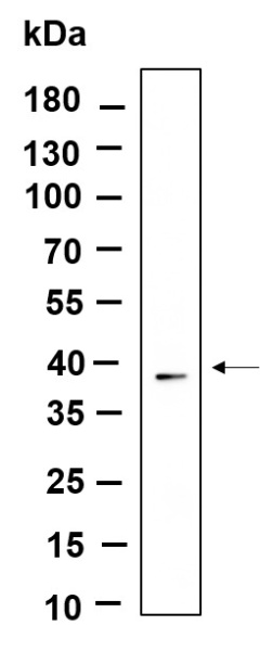Recombinant Nucleophosmin Monoclonal Antibody (AN301122L)