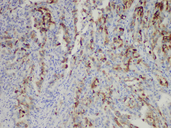 COX-2 Monoclonal Antibody (ELAB6678-M)