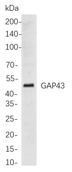 Recombinant GAP43 Monoclonal Antibody (AN300868L)