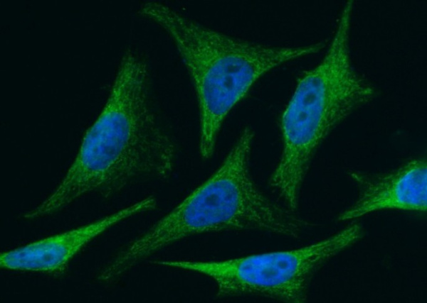 Recombinant BID Monoclonal Antibody (AN300060P)