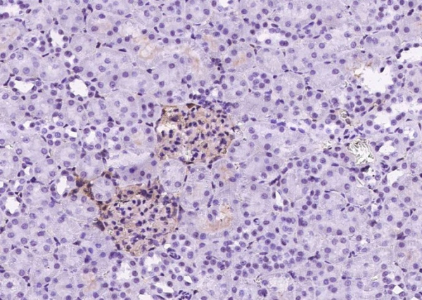 Recombinant ICAM-1/CD54 Monoclonal Antibody (AN300578P)