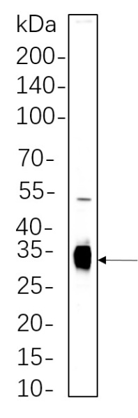 Recombinant Caspase-6 Monoclonal Antibody (AN300631L)