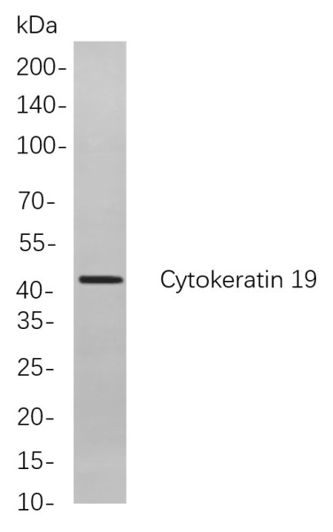 Recombinant Cytokeratin 19 Monoclonal Antibody (AN300920L)