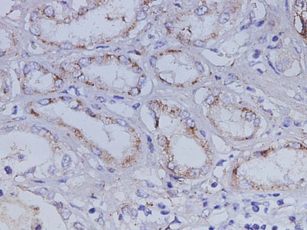 IGFBP7 Polyclonal Antibody (D-AB-10467L)