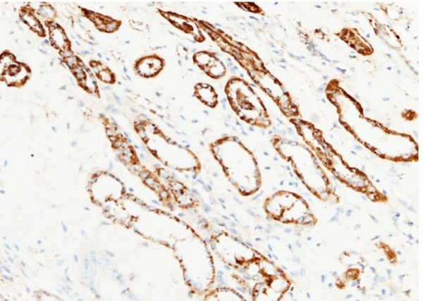 Recombinant CD13/ANPEP Monoclonal Antibody (AN300044P)