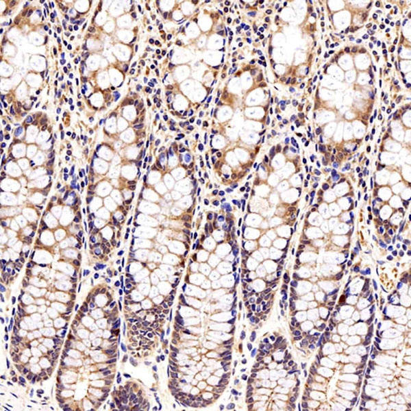Galectin 3 Polyclonal Antibody (E-AB-70105)
