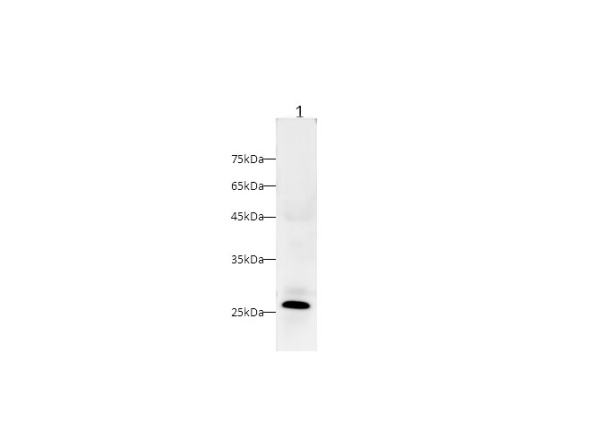 CRP Polyclonal Antibody (D-AB-10393L)