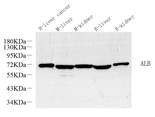 ALB Polyclonal Antibody (E-AB-70182)
