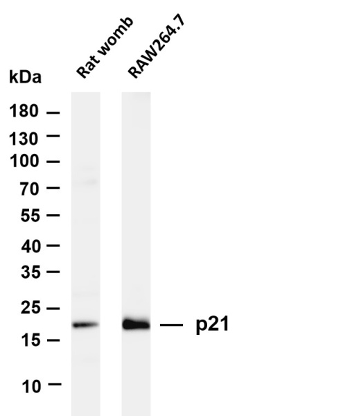 Recombinant p21 Monoclonal Antibody (AN300840L)