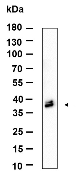 Recombinant ApoE Monoclonal Antibody (AN301133L)