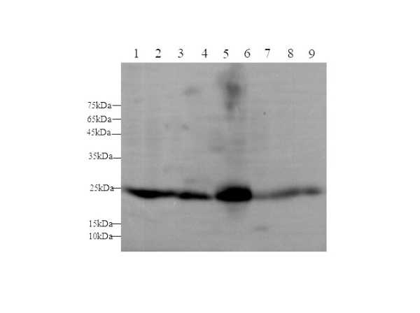 GSTA1 Polyclonal Antibody (D-AB-10180L)