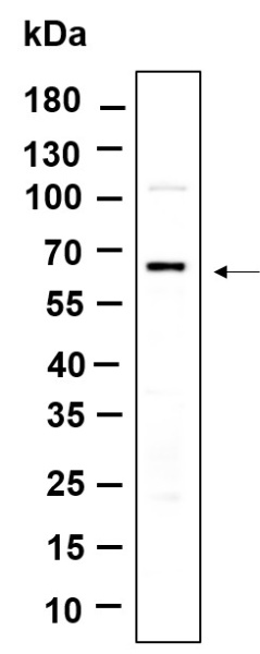 Recombinant PINK1 Monoclonal Antibody (AN301386L)