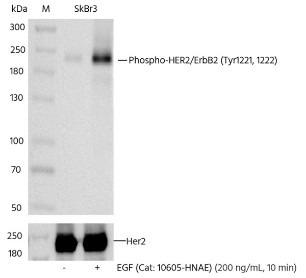 Recombinant Phospho-HER2/ErbB2 (Tyr1221, 1222) Monoclonal Antibody (AN300005L)