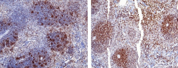 Recombinant CD2 Monoclonal Antibody (AN300532P)