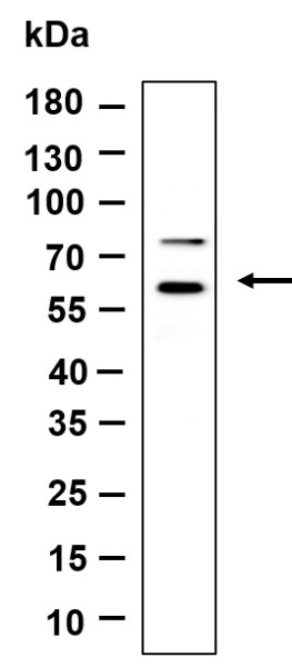 Recombinant HspA14 Monoclonal Antibody (AN301227L)