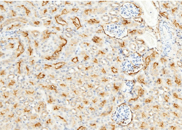 Recombinant CD13/ANPEP Monoclonal Antibody (AN300455P)