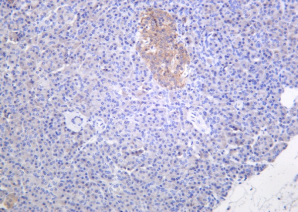 Recombinant Musashi-1 Monoclonal Antibody (AN301243L)