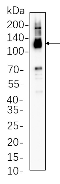 Recombinant Notch2 Monoclonal Antibody (AN301371L)
