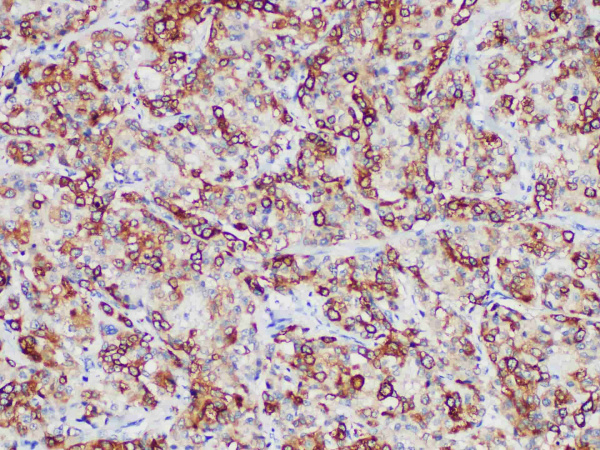 RRM1 Monoclonal Antibody (ELAB6973-R)