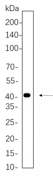 Recombinant MEK4 Monoclonal Antibody (AN300825L)