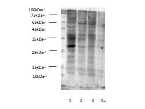 Succinylated Lysine Polyclonal Antibody (E-AB-40542)