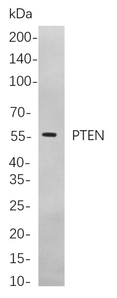 Recombinant PTEN Monoclonal Antibody (AN301026L)