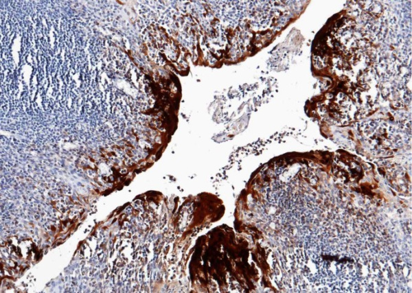 Recombinant S100A7 Monoclonal Antibody (AN300383P)