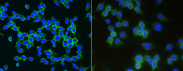 Recombinant LDLR/LDL Receptor Monoclonal Antibody (AN300505P)
