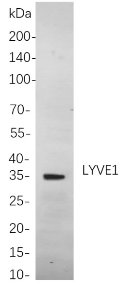 Recombinant LYVE1 Monoclonal Antibody (AN300899L)