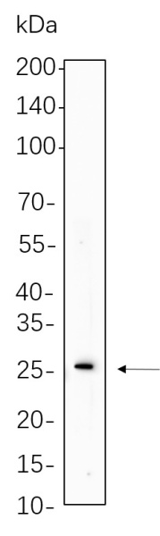 Recombinant Cleaved PARP1 Monoclonal Antibody (AN301380L)