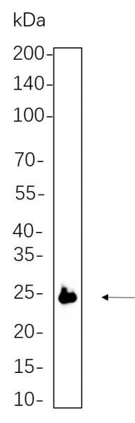 Recombinant eIF4E Monoclonal Antibody (AN300668L)