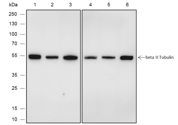 Recombinant beta II Tubulin Monoclonal Antibody (AN301880L)