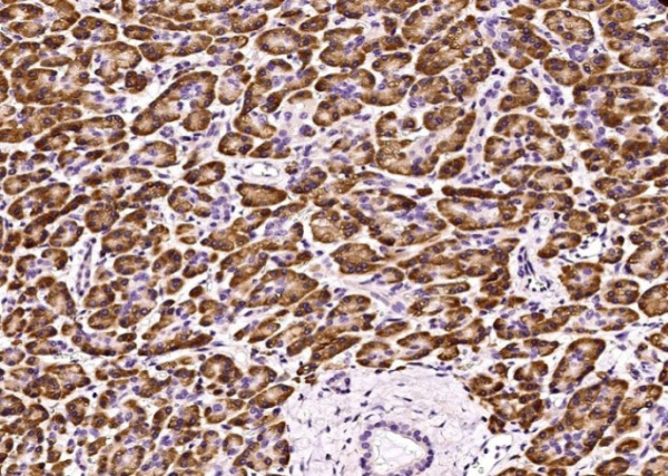 FGFR1/CD331 Monoclonal Antibody (AN200107P)