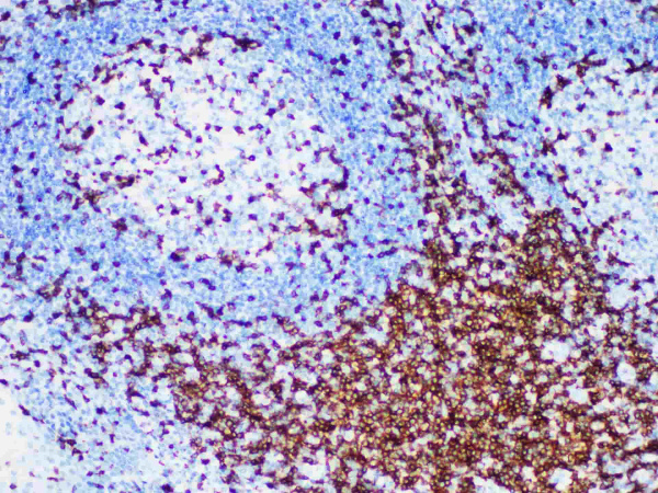 CD7 Monoclonal Antibody (ELAB6159-M)
