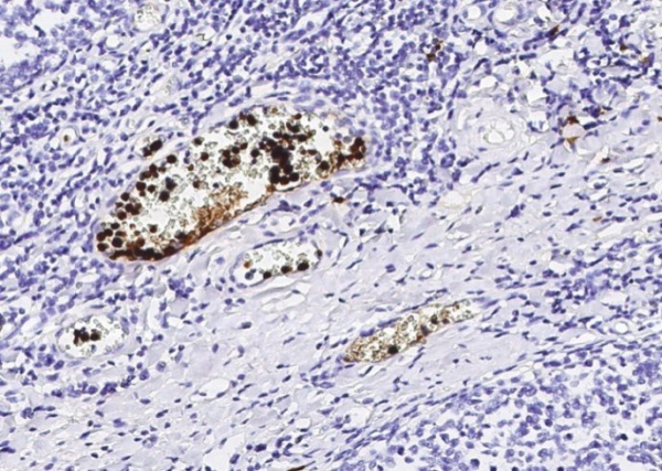 Recombinant S100A12 Monoclonal Antibody (AN300131P)