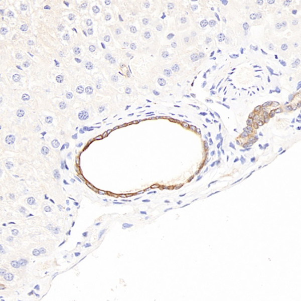 CK-7 Polyclonal Antibody (E-AB-70092)