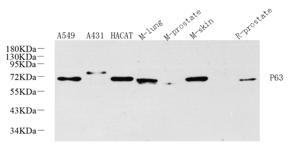 p63 Polyclonal Antibody (E-AB-70281)