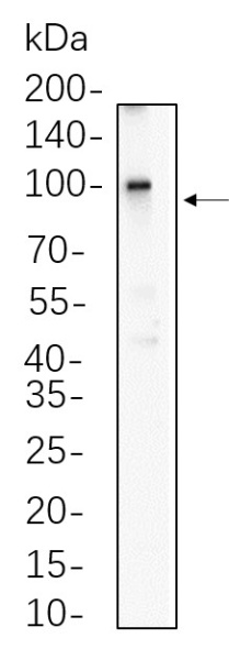 Recombinant Phospho-β Catenin (Thr41, Ser45) Monoclonal Antibody (AN300736L)