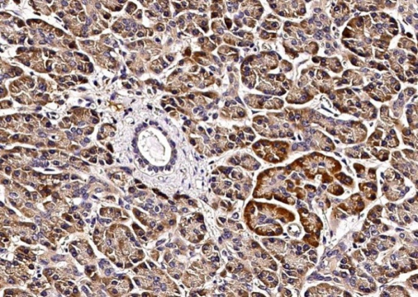 Recombinant VAPB/VAP-B Monoclonal Antibody (AN300202P)