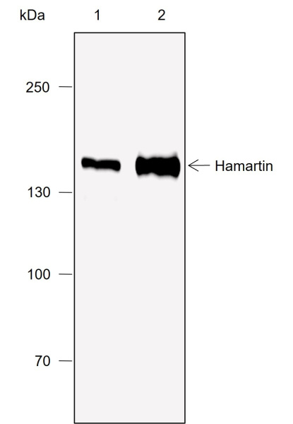 Recombinant Hamartin Monoclonal Antibody (AN302053L)