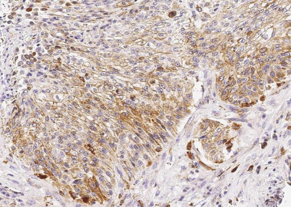Recombinant Cathepsin D/CTSD Monoclonal Antibody (AN300423P)