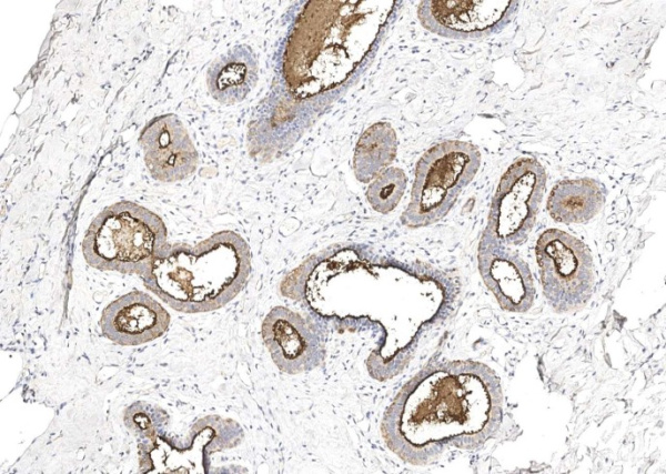 Recombinant MUC1 Monoclonal Antibody (AN300416P)