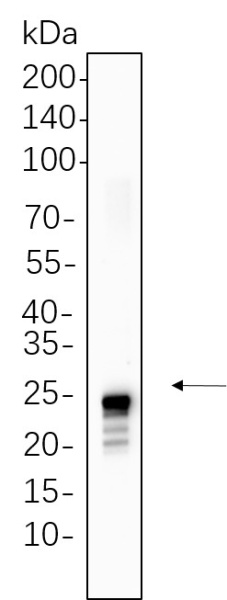 Recombinant TAGLN Monoclonal Antibody (AN301370L)