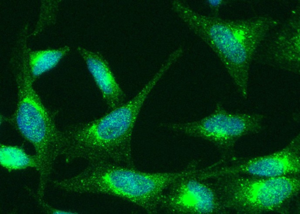 Recombinant TNFR1/CD120a/TNFRSF1A Monoclonal Antibody (AN300351P)